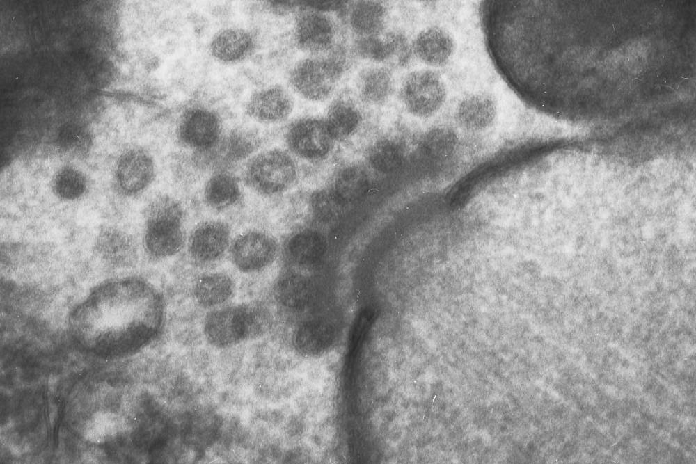 The cell biology of sporulation in yeast