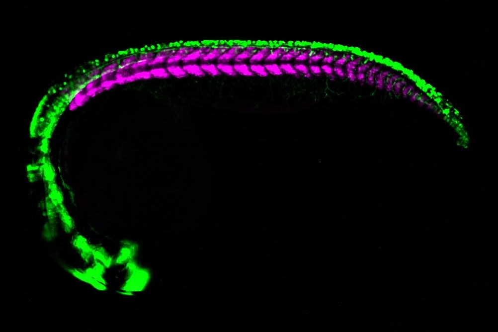 Stem cell maintenance and differentiation, Developmental mechanisms of cancer pathogenesis