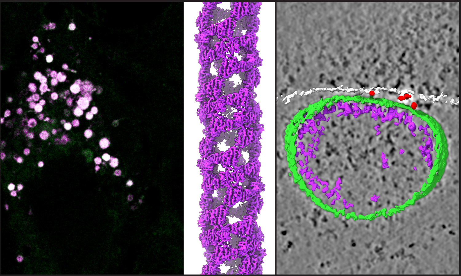 Spatiotemporal regulation of metabolic enzymes