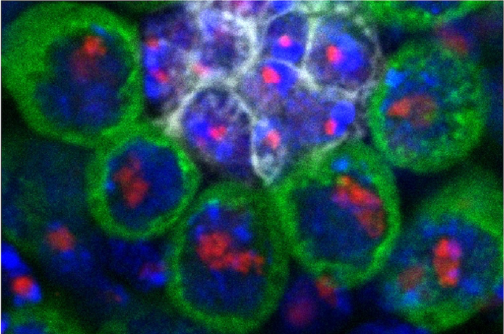 Repetitive DNA maintenance and retrotransposon activity in germ cell immortality