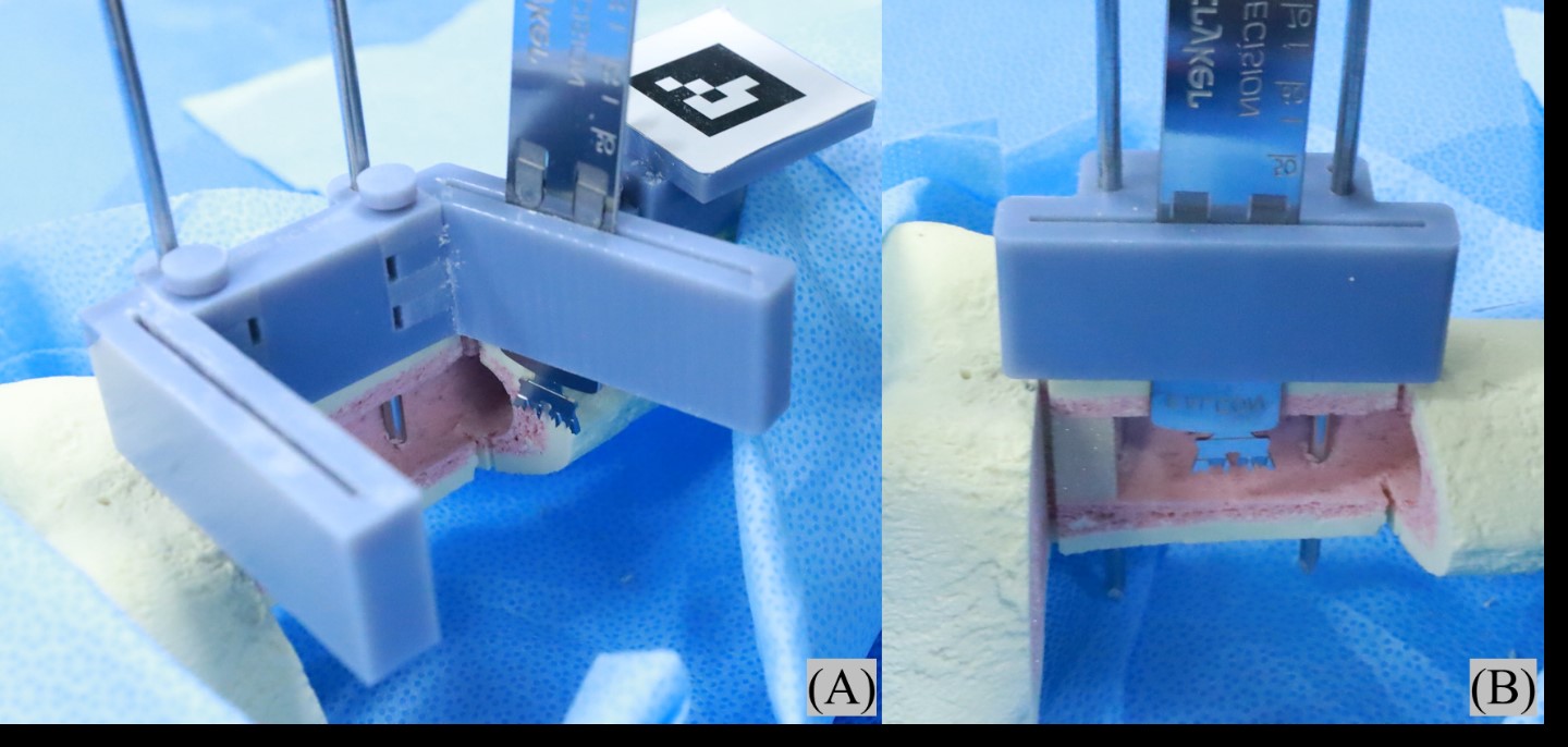 Device for conducting bone surgery 