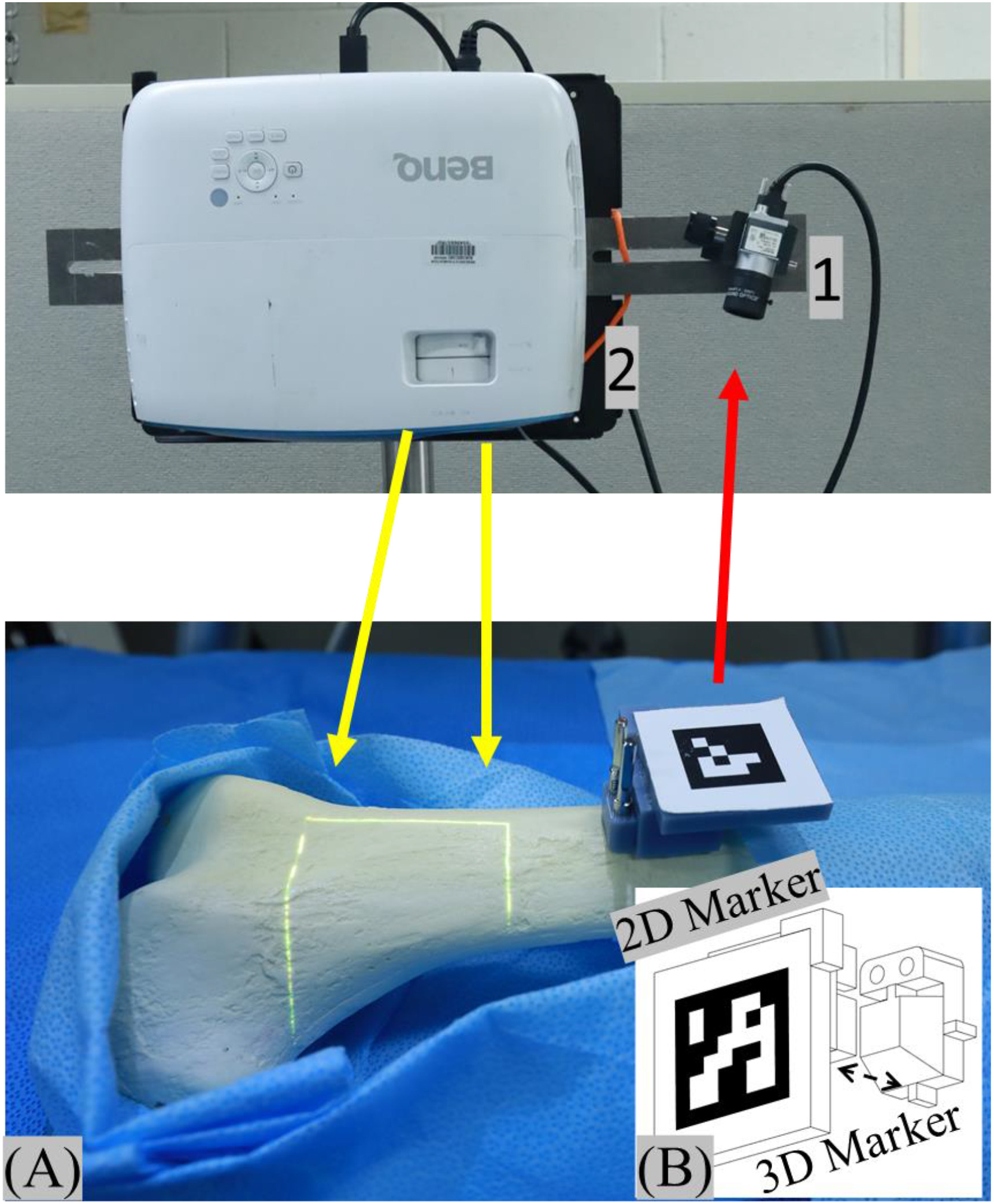 Robotic surgical system with a bone sample on a blue drape, projecting green laser lines onto the bone, accompanied by a 2D marker for augmented reality guidance and a wall-mounted projector.