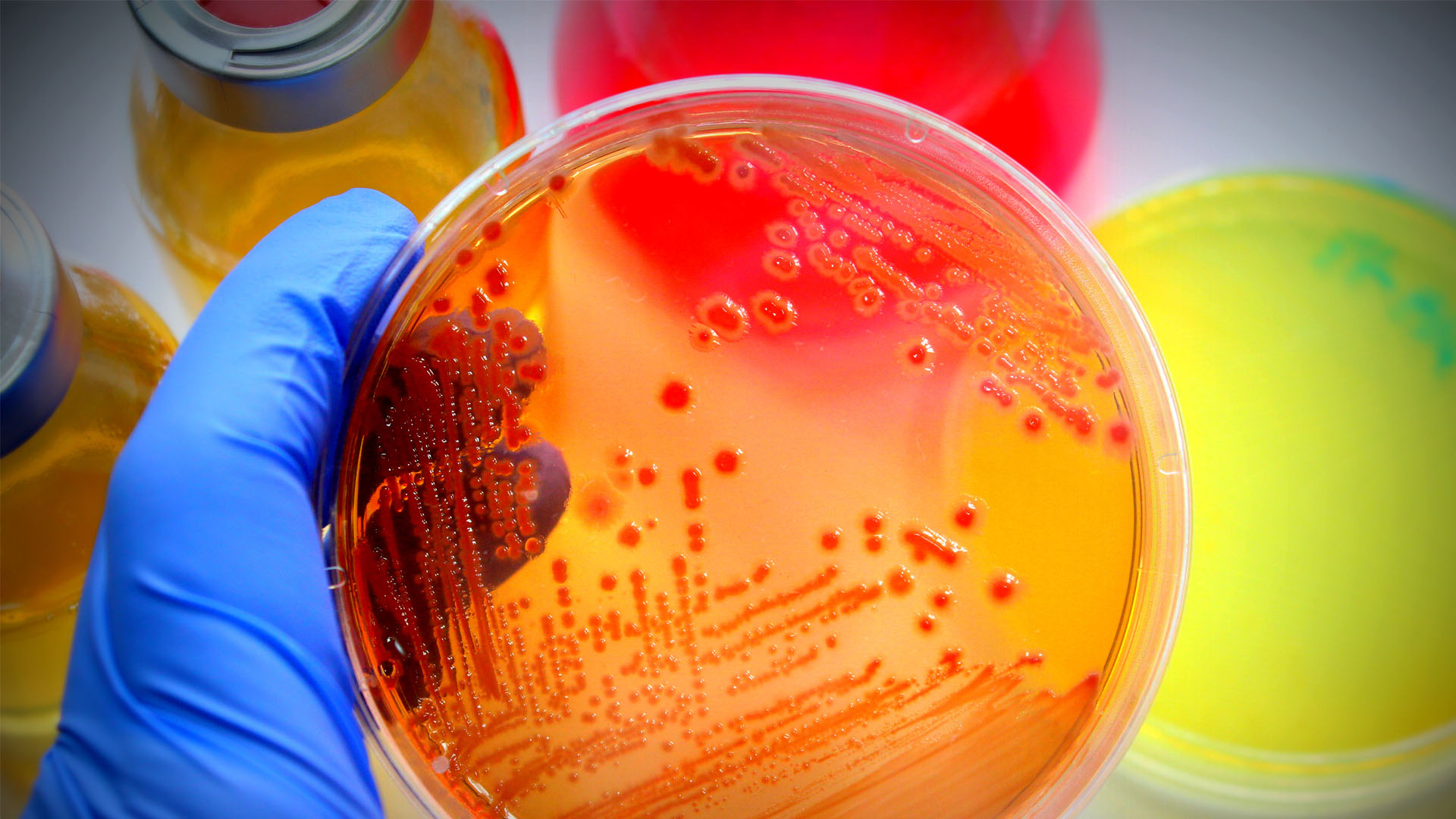 a picture of a colorful petry dish with some cells showing
