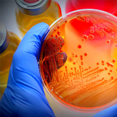 hand holding petri dish with bacterial growth on it