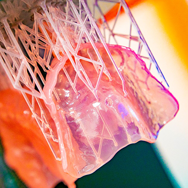 orange and yellow image of dental appliance