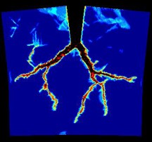 3D reconstruction or scan of a branching structure