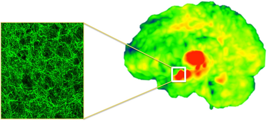 DeLorenzo_cholinergic