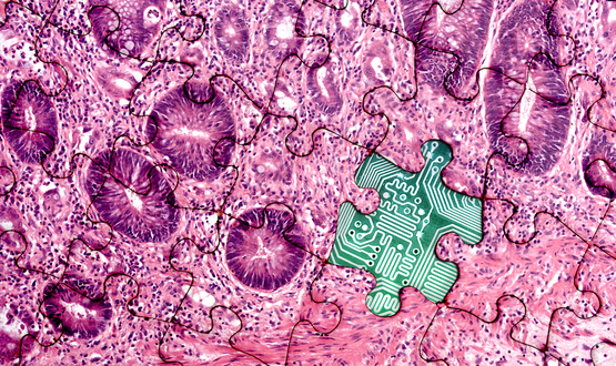 Digital Pathology and Tumor Microenvironment | Institute for  Engineering-Driven Medicine