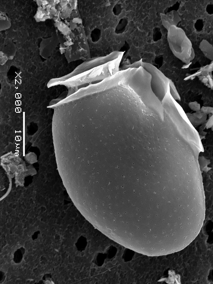 Dinophysis