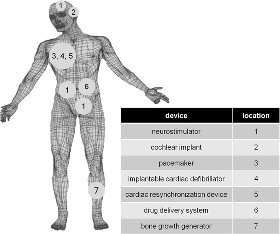 Diagram of human body