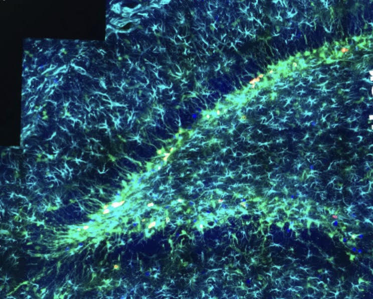 Neurons in the dentate gyrus of the hippocampus