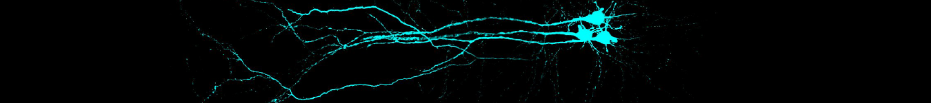 Three filled neurons
