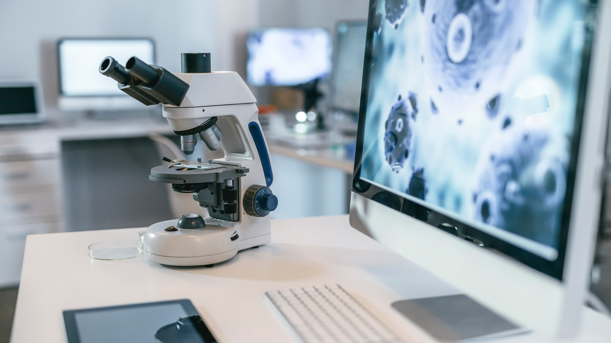 A microscope sits on a laboratory workbench next to a computer monitor displaying a microscopic view of cells.